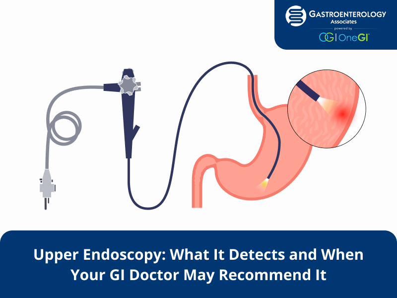 Diagram of an upper endoscopy procedure in the stomach.